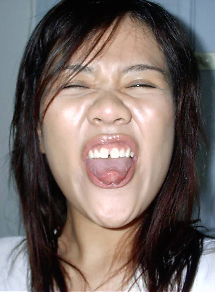 Negative example of tongue extension
