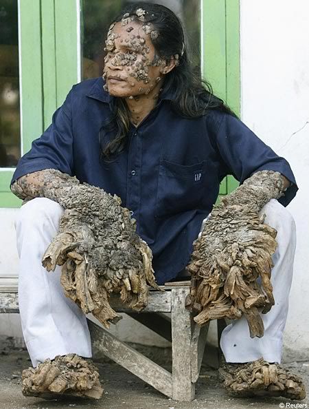 http://i5.photobucket.com/albums/y163/MageGrayWolf/tree-man-2.jpg