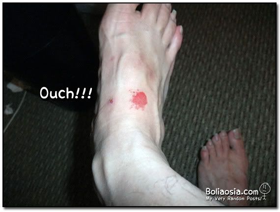 ouch