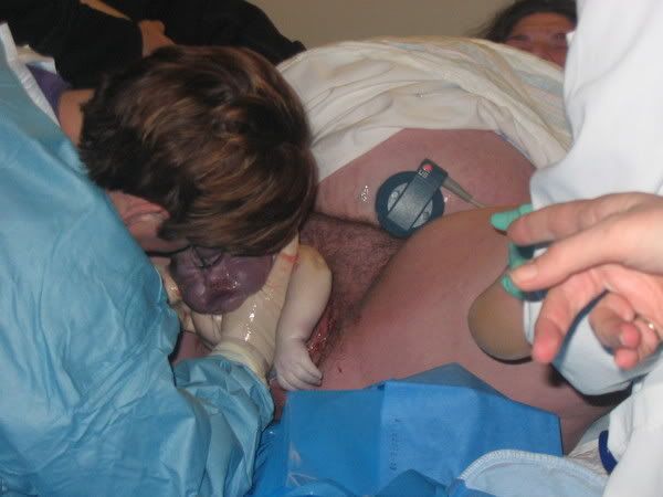 Childbirth Pictures Graphic